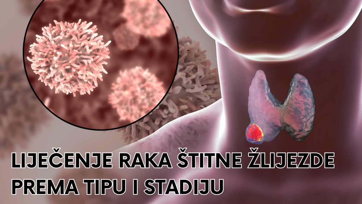 Liječenje raka štitne žlijezde prema tipu i stadiju